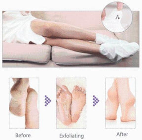 Exfoliating Foot-Peel Refreshing Mask (Set of 3)