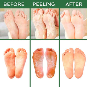 Exfoliating Foot-Peel Refreshing Mask (Set of 3)